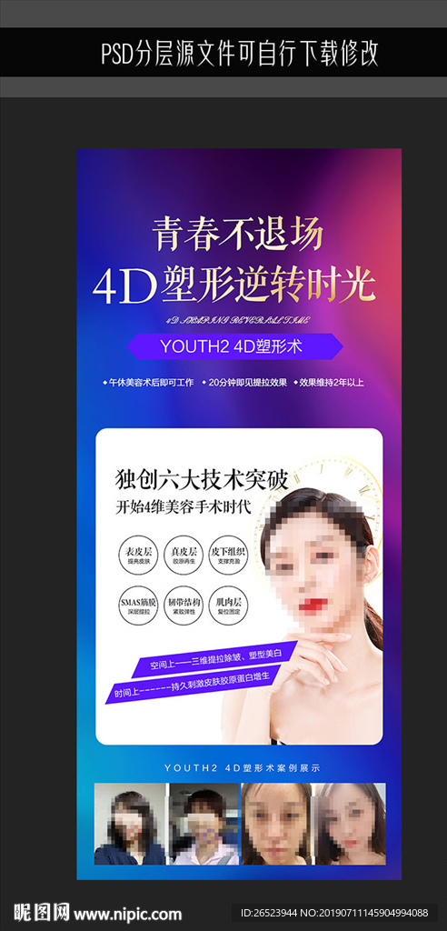线雕
