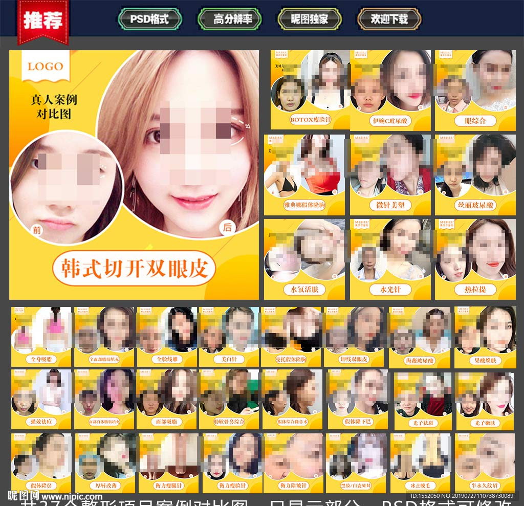 整形案例对比图