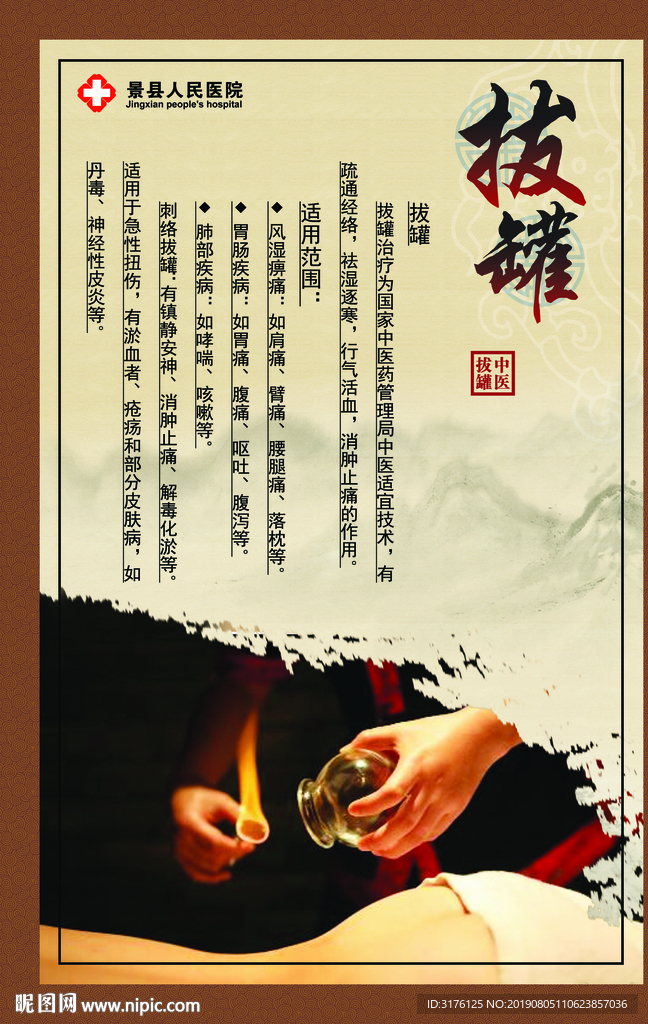 拔罐 针灸治疗 中医 中风病