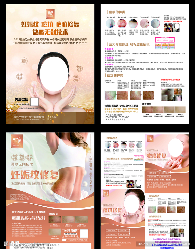 抖疤 疤痕修复
