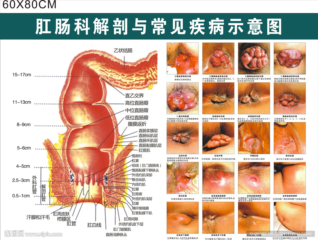 腊肠科解剖与常见疾病示意图