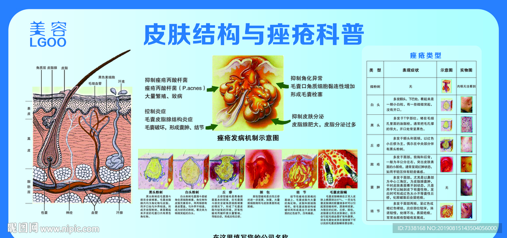 皮肤结构与痤疮科普