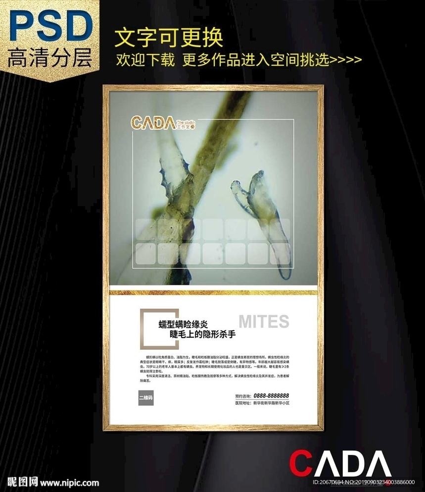 干眼治疗-蠕形螨