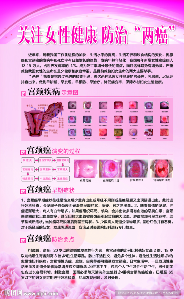 宫颈癌防治