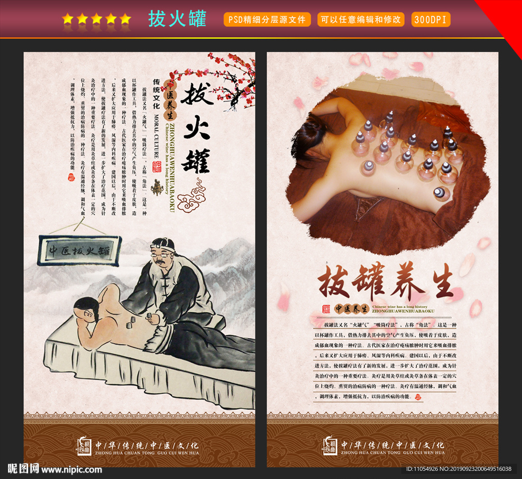 拔火罐