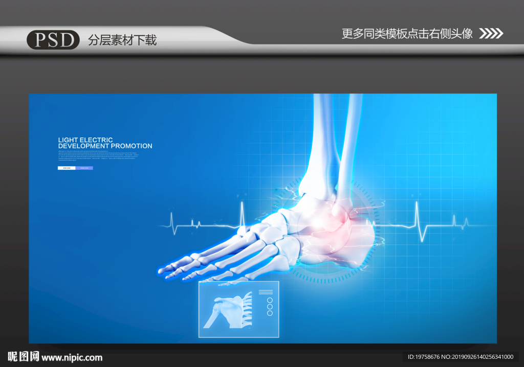 脚关节