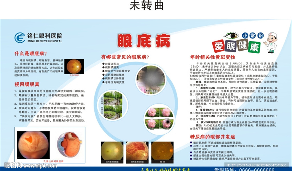 眼科眼底病