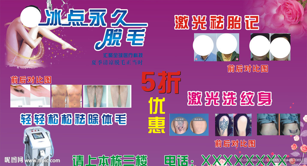 冰点永久脱毛 祛斑 洗纹身