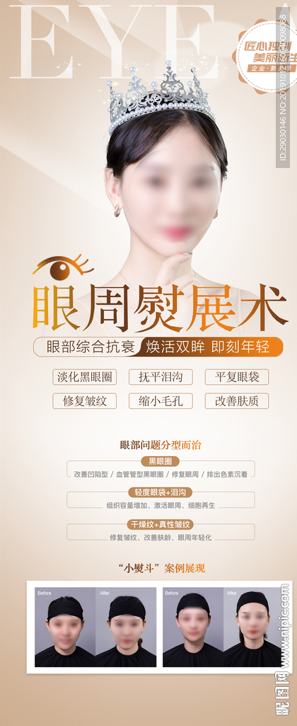 眼周除皱展架