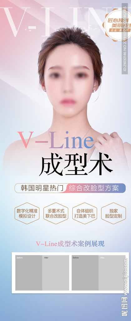 下颌缘提升展架