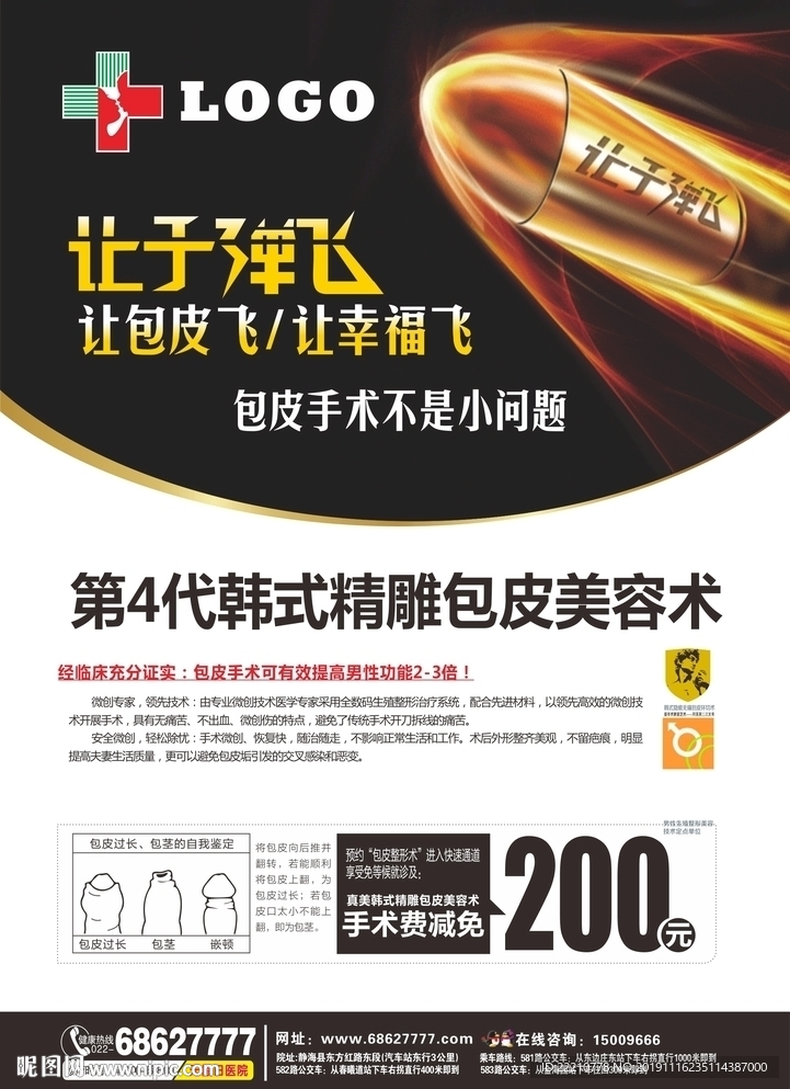 韩国包皮手术