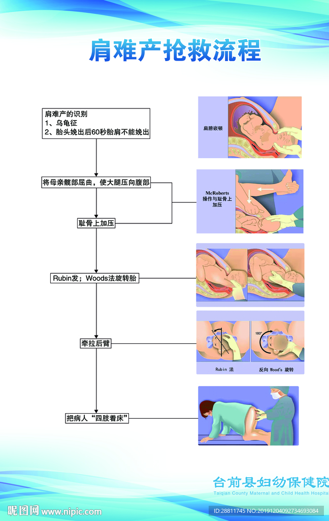 肩难产抢救流程图