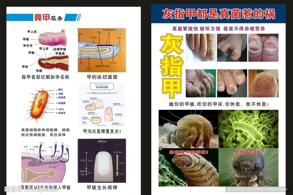 灰指甲