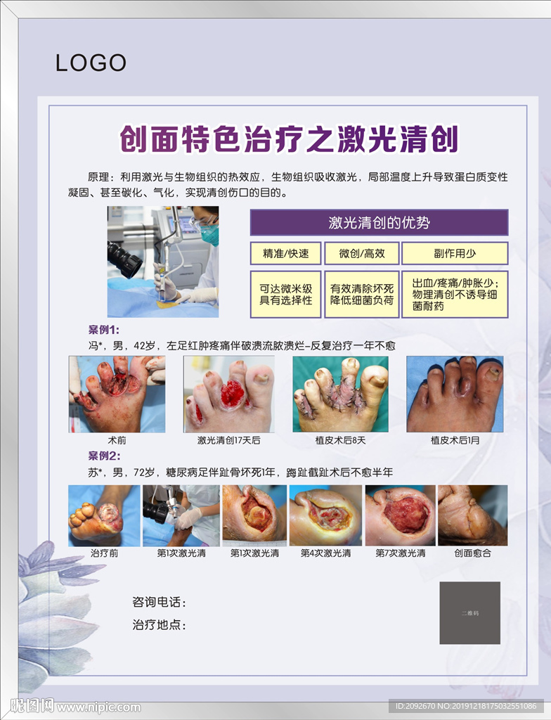 激光清创整形