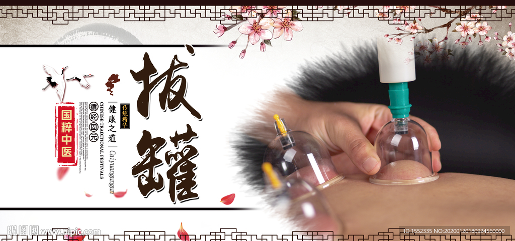 拔罐