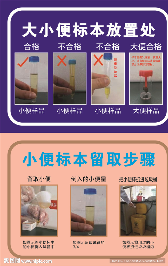 大小便标本留取
