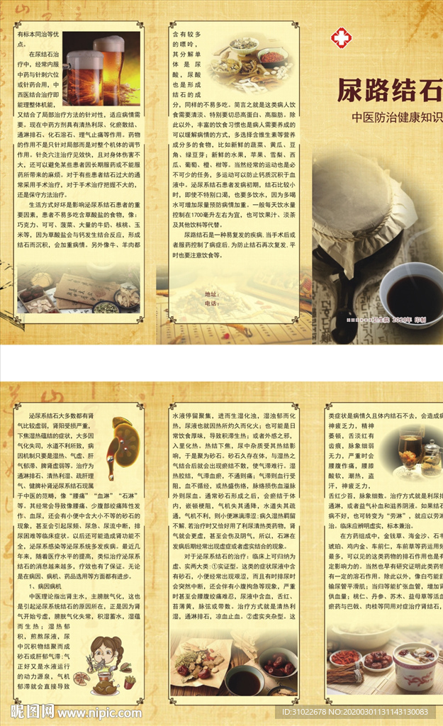 尿路结石