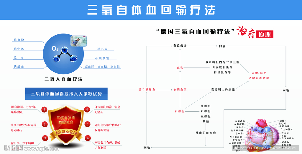 三氧自体血回输疗法展板