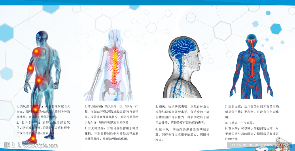 三氧自血疗法病症解析展板