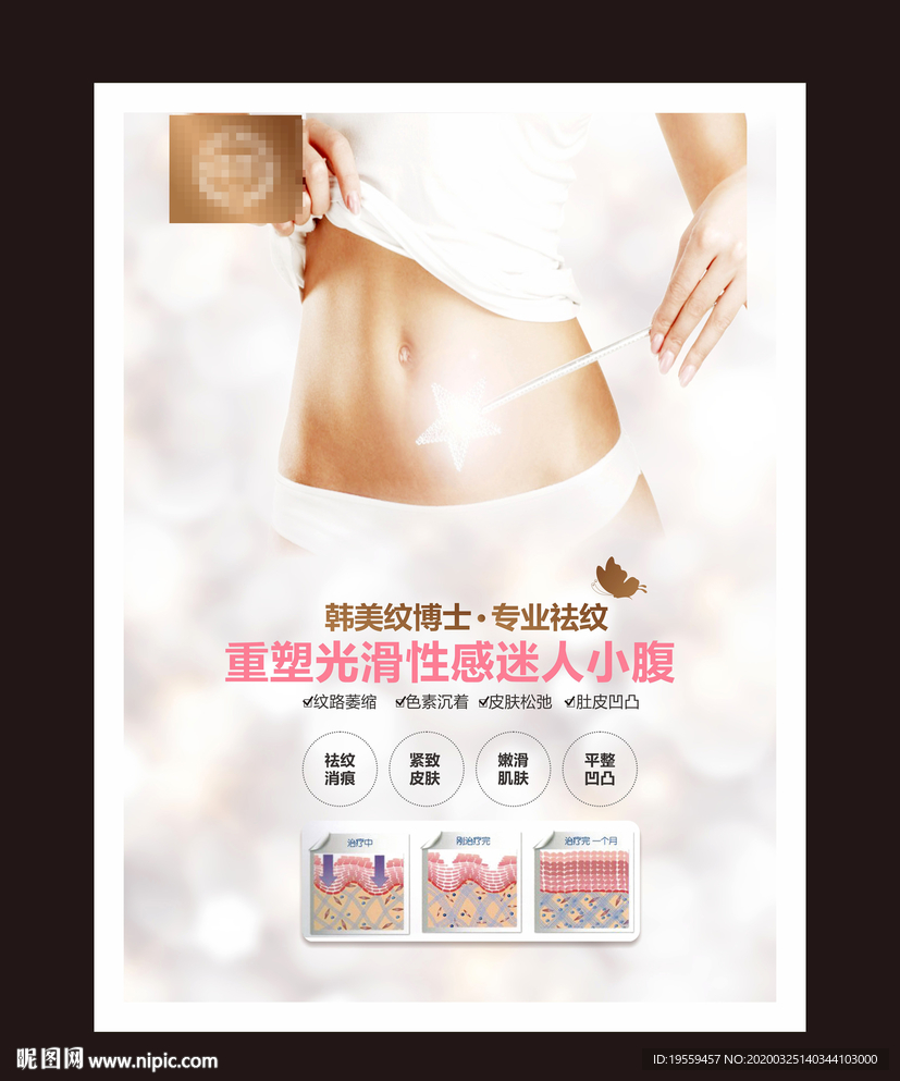 妊娠纹海报