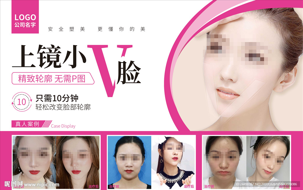 瘦脸整形美女案例海报图片