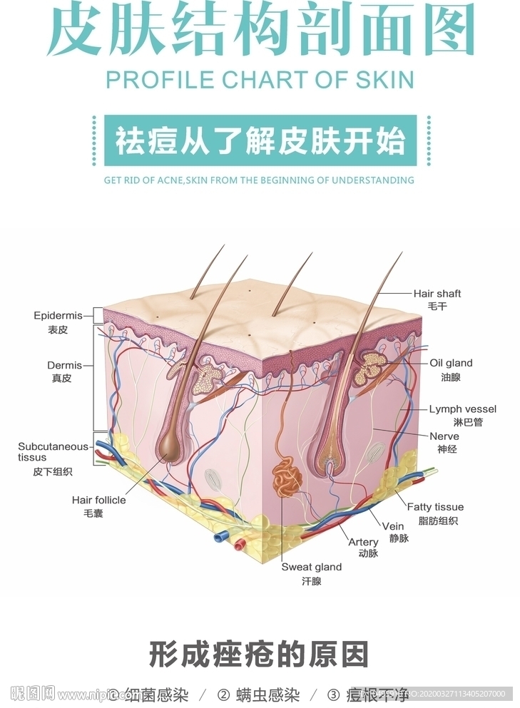 皮肤结构剖面图 祛痘 痤疮形成