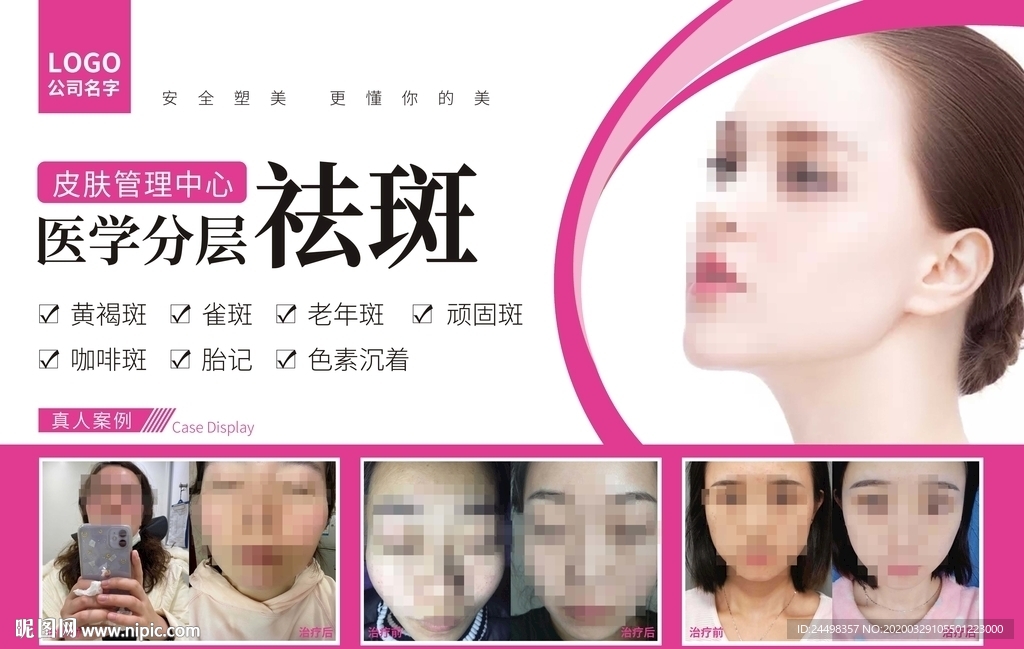 祛斑整形美女案例海报图片