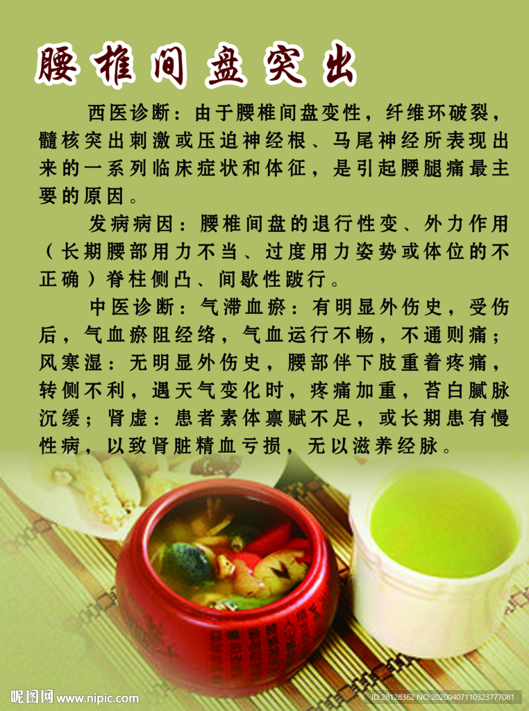 腰间盘突出