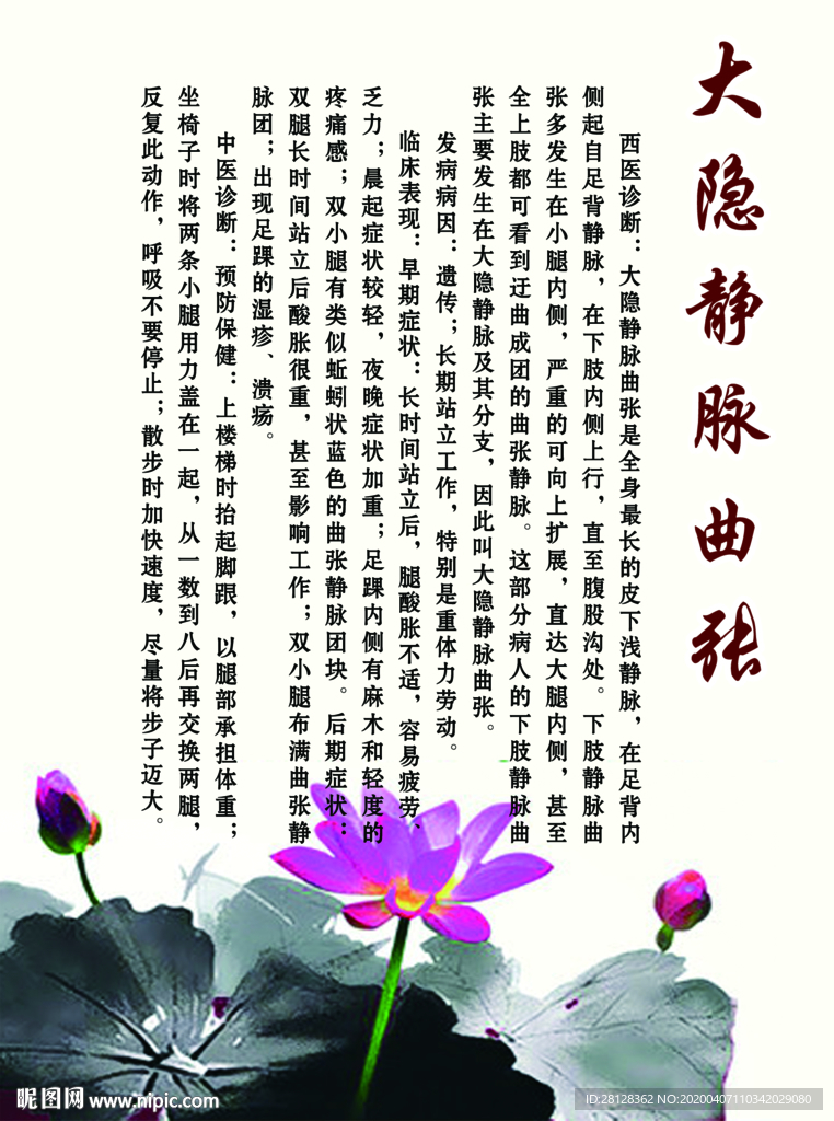 静脉曲张