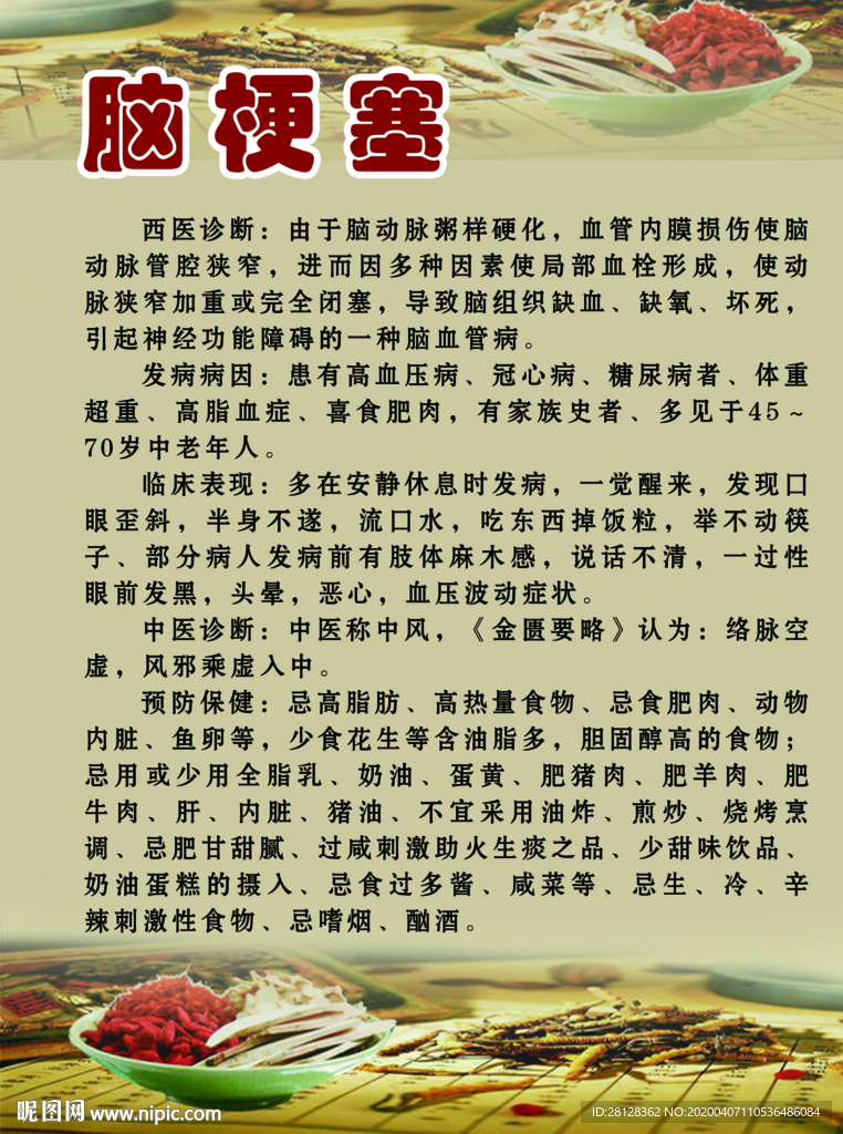 脑梗塞