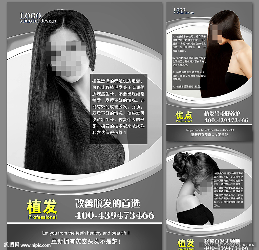 植发的优点