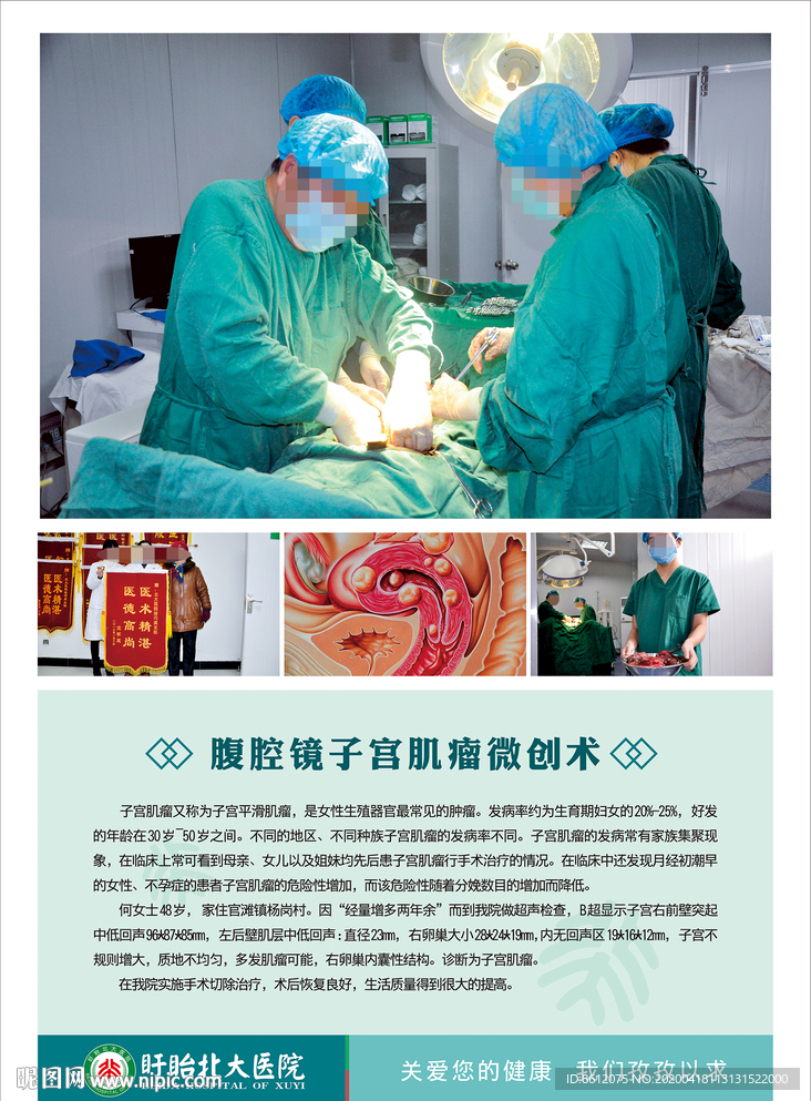 子宫肌瘤案例