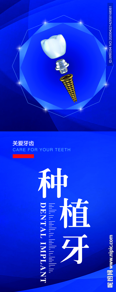 种植牙
