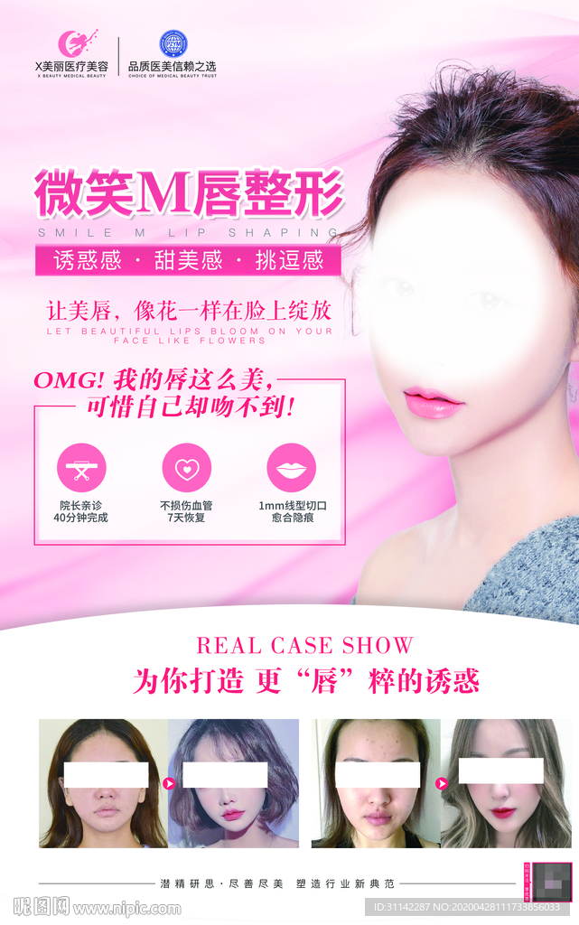 微笑M唇整形海报图片