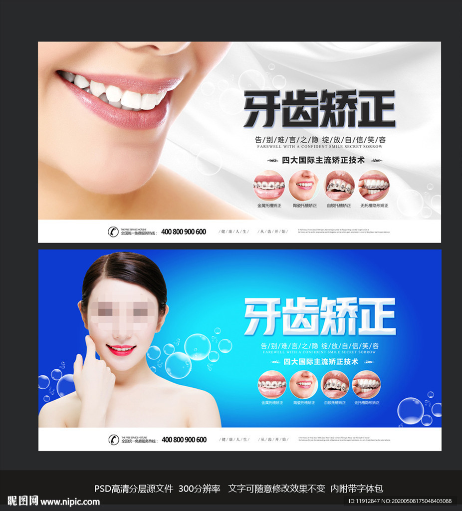 牙齿矫正