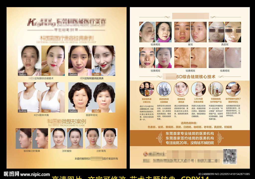 案例单张