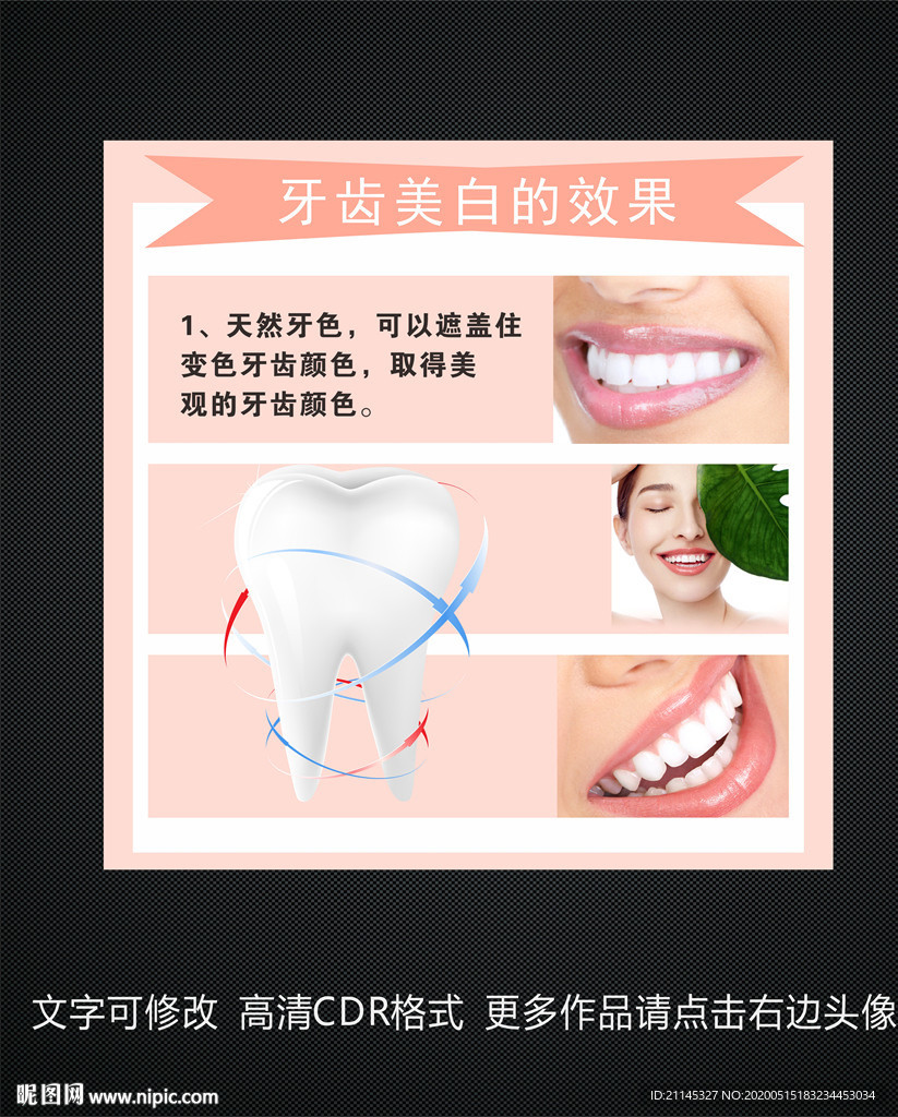牙科美白