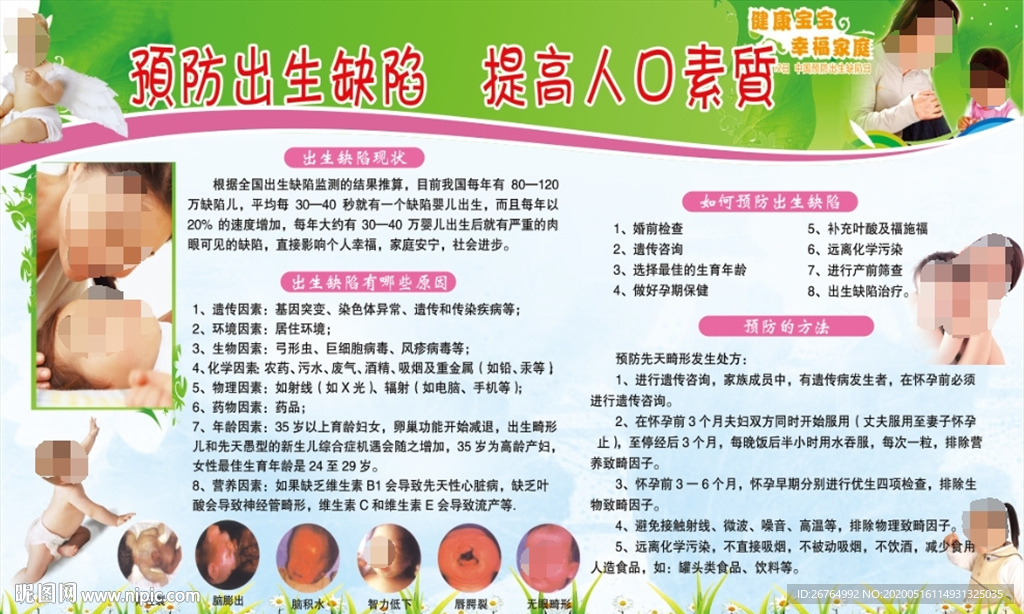 出生缺陷篇2.89 x 1.p