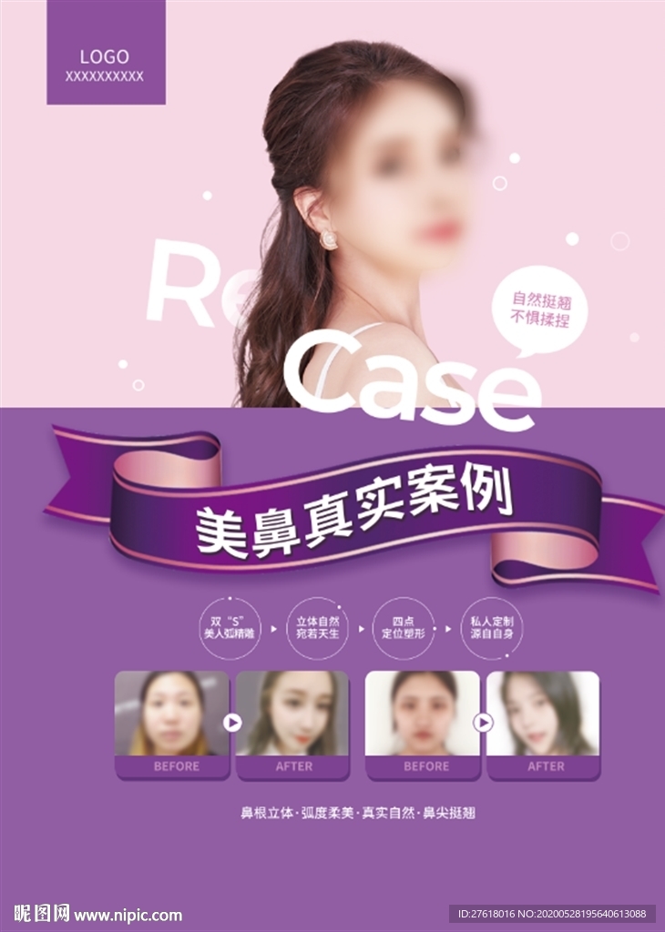 整形海报