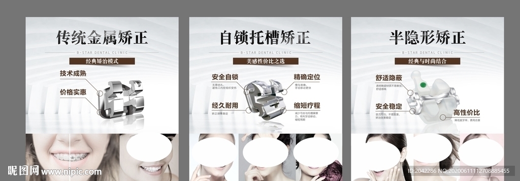 牙齿矫正类型