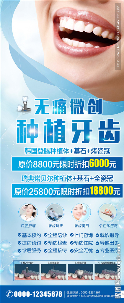 种植牙齿展架