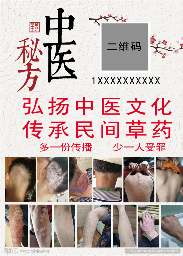 中医秘方