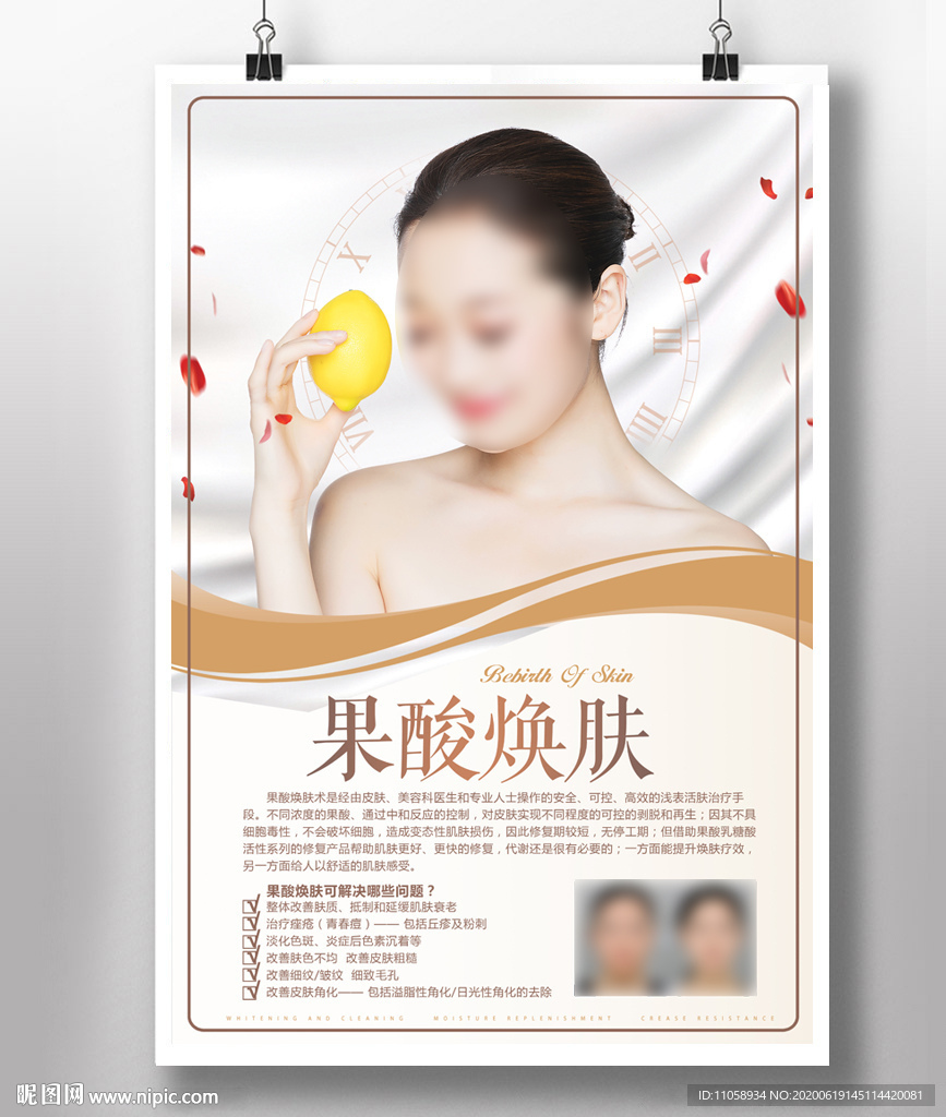 果酸焕肤