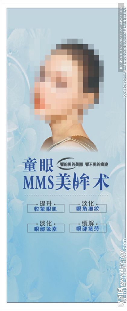 美眸术 双眼皮 韩式双眼皮 眼