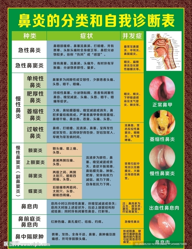 鼻炎的分类和自我诊断表