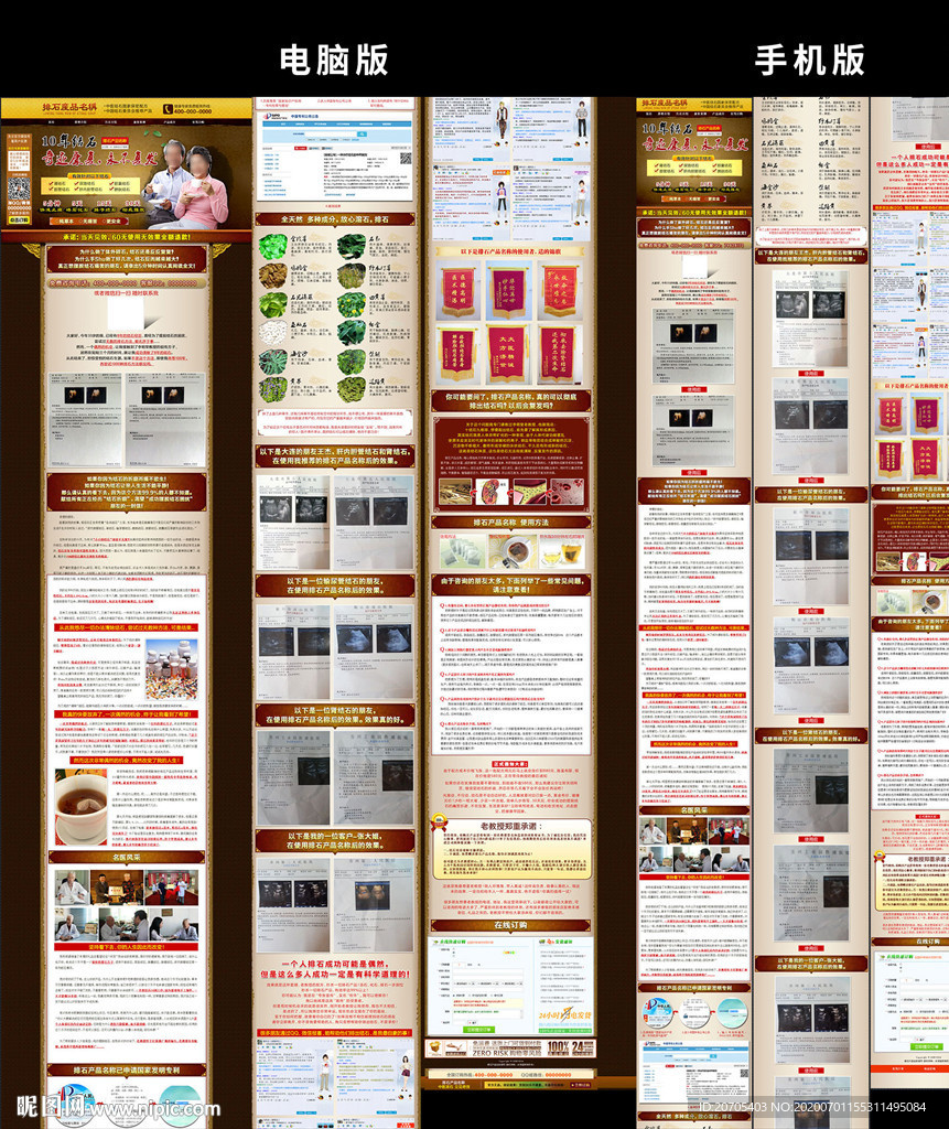 胆结石单页竞价