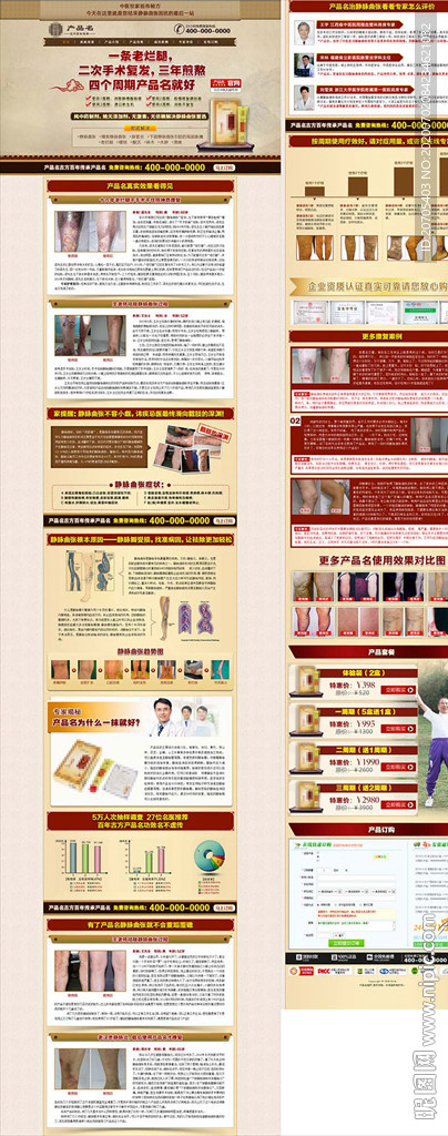 静脉曲张单页竞价