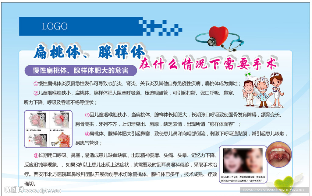 扁桃体腺样体手术