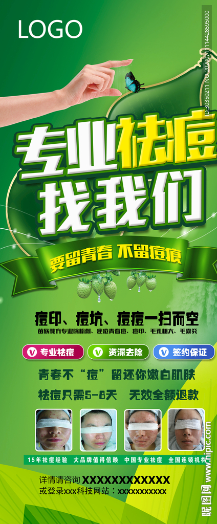 专业祛痘找我们