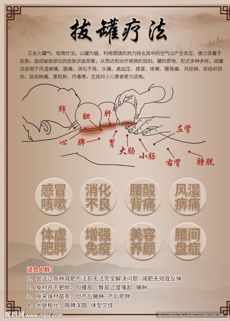 拔罐疗法展板